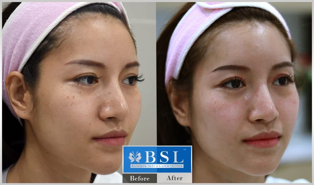 bright-white-skin-07-img