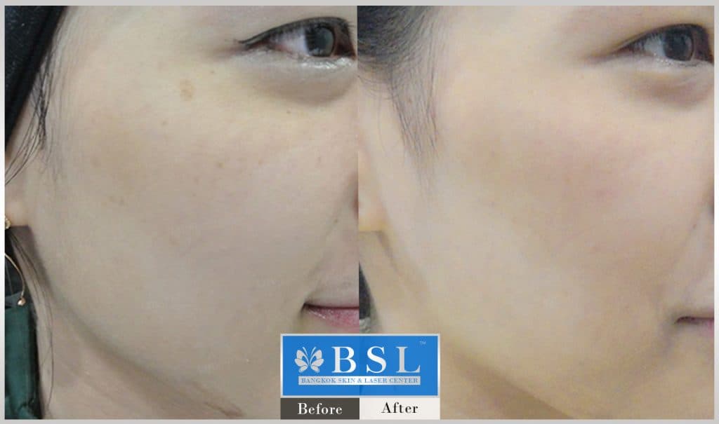bright-white-skin-08-img