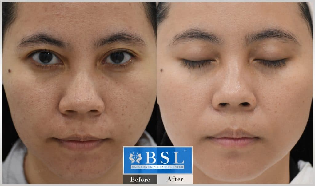 sensitive-skin-09-img