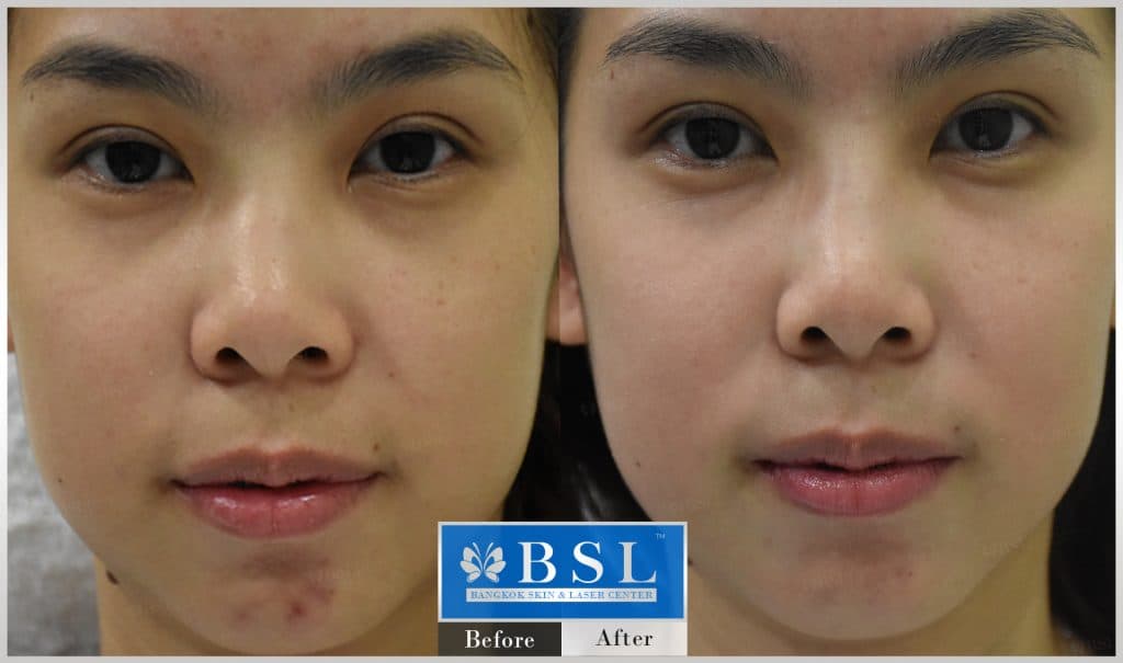sensitive-skin-10-img