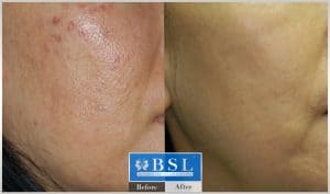 treatments-17-23