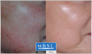 treatments-17-24
