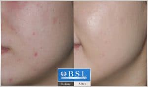 treatments-17-25