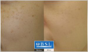 treatments-17-26
