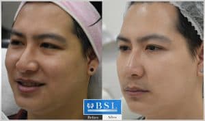 treatments-19-15
