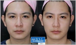 treatments-19-17