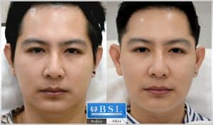 treatments-19-18