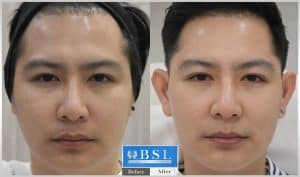 treatments-19-19