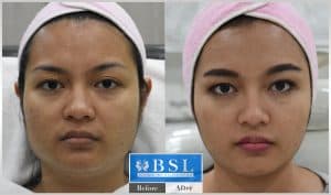 treatments-19-20
