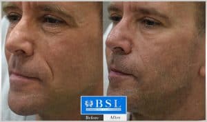 treatments-19-22