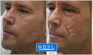 treatments-19-23