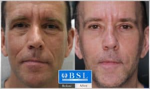 treatments-19-24