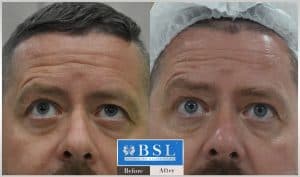 treatments-19-25