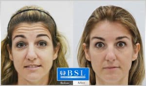 treatments-19-26