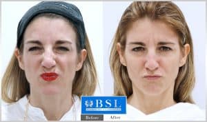 treatments-19-27