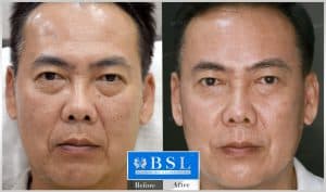 treatments-19-31