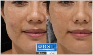 treatments-20-20