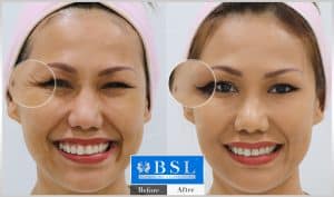 treatments-25-25