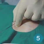 treatments-32-13