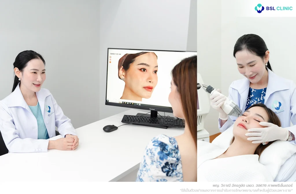 รักษาสิวที่ BSL Clinic