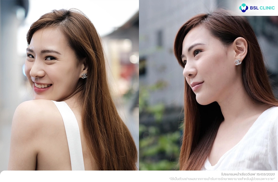หน้าเรียววีเชฟ