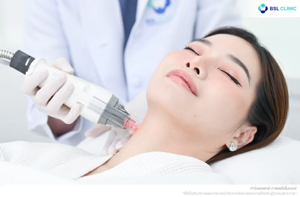 Fraxel Laser Program BSL Clinic