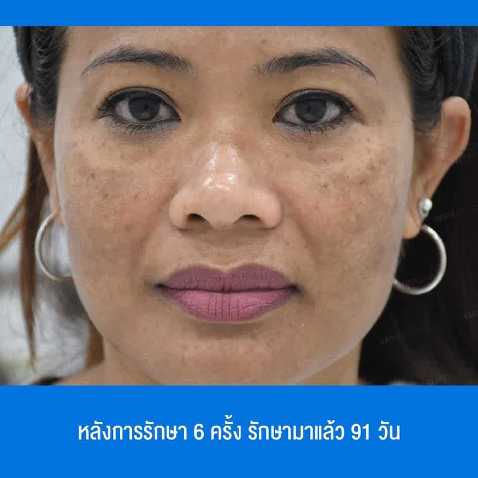 blog-story-12-09-07