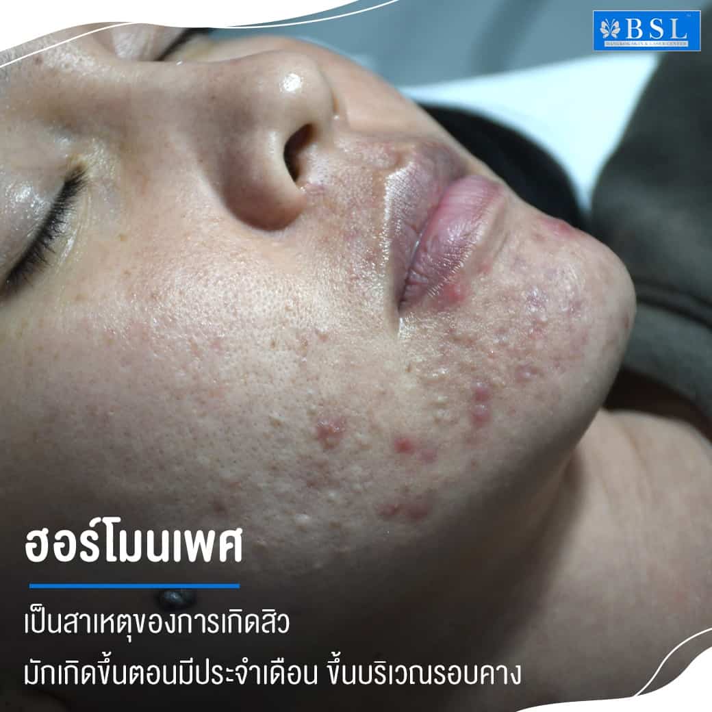 blog-story-14-07-01