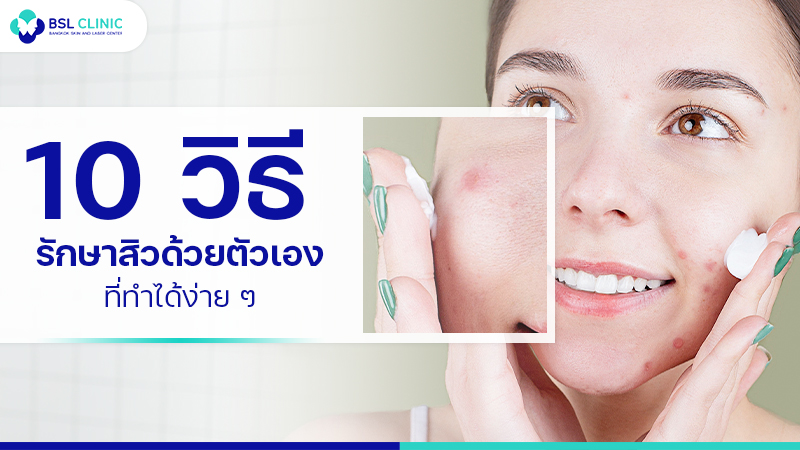 10 วิธีรักษาสิวด้วยตัวเอง ที่ทำได้ง่าย ๆ Bslclinic-acne-treatments-feature-img-40