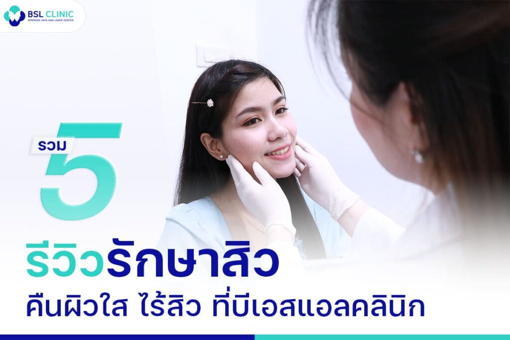 5 รีวิวรักษาสิว เผยผิวใส สิวจางลง ที่บีเอสแอลคลินิก