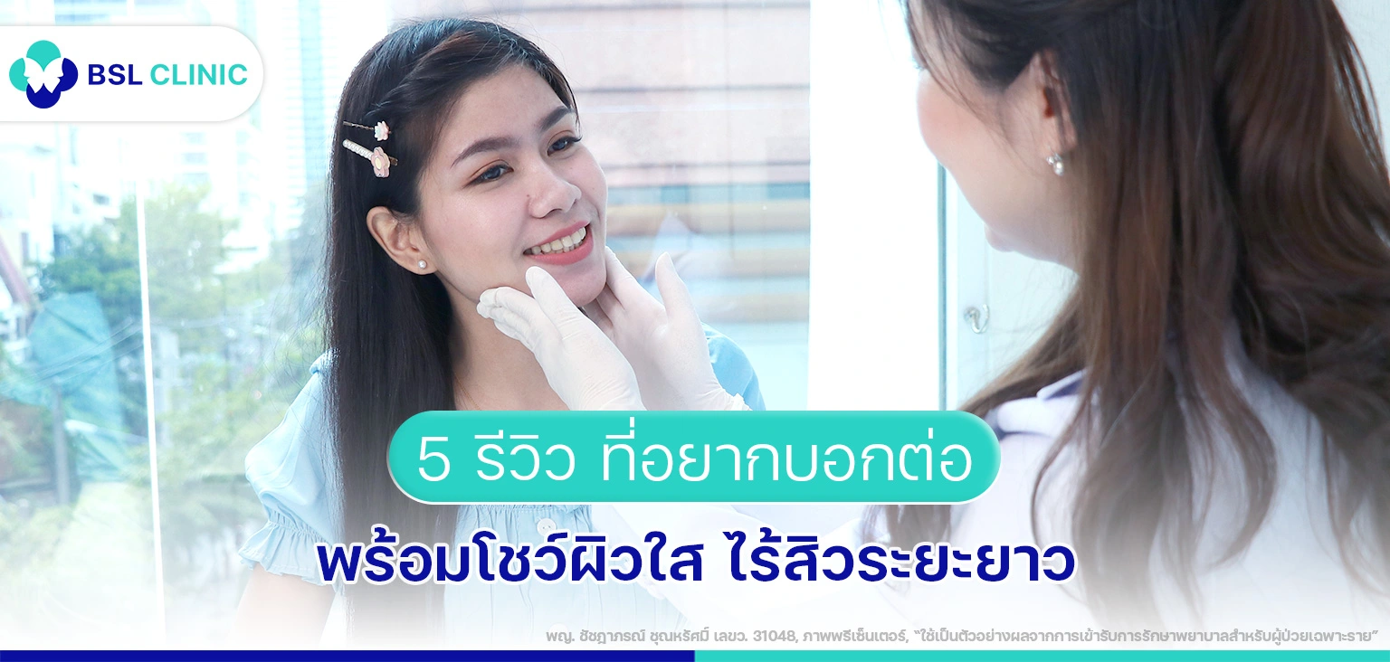5-รีวิวพร้อมโชว์ผิวใส-ไร้สิวระยะยาว