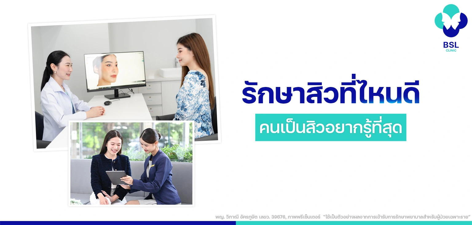 ปี 2025 รักษาสิวที่ไหนดี