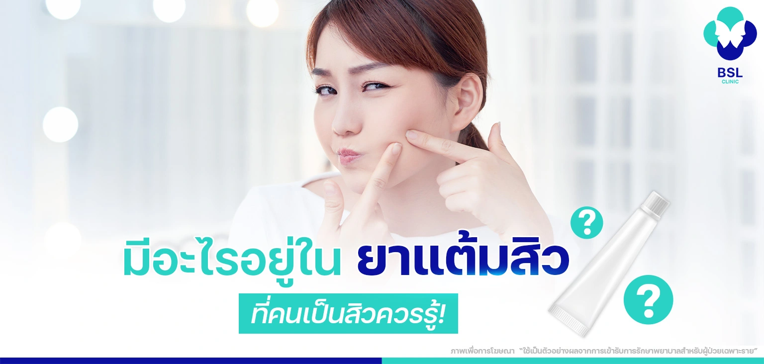 มีอะไรอยู่ในยาแต้มสิว