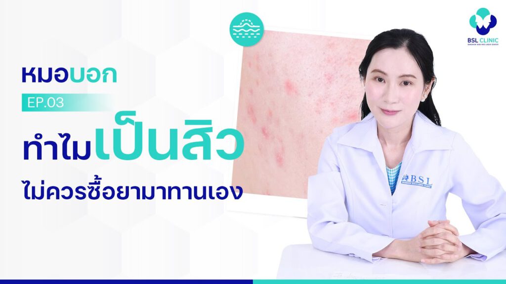 ทำไมยารักษาสิว ไม่ควรซื้อกินเอง BSL CLINIC หมอบอก EP.3