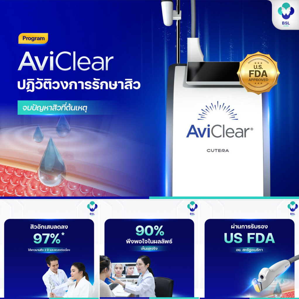 AviClear-Laser-ปฏิวัติวงการรักษาสิว