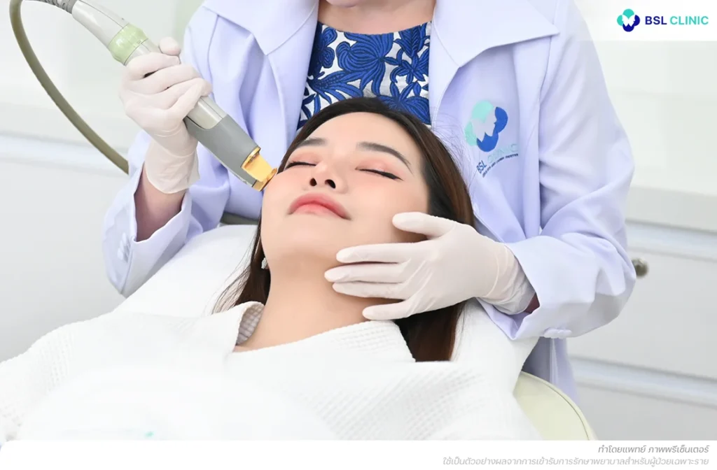 โปรแกรมเลเซอร์ฝ้าเส้นเลือด รักษาฝ้ากระ