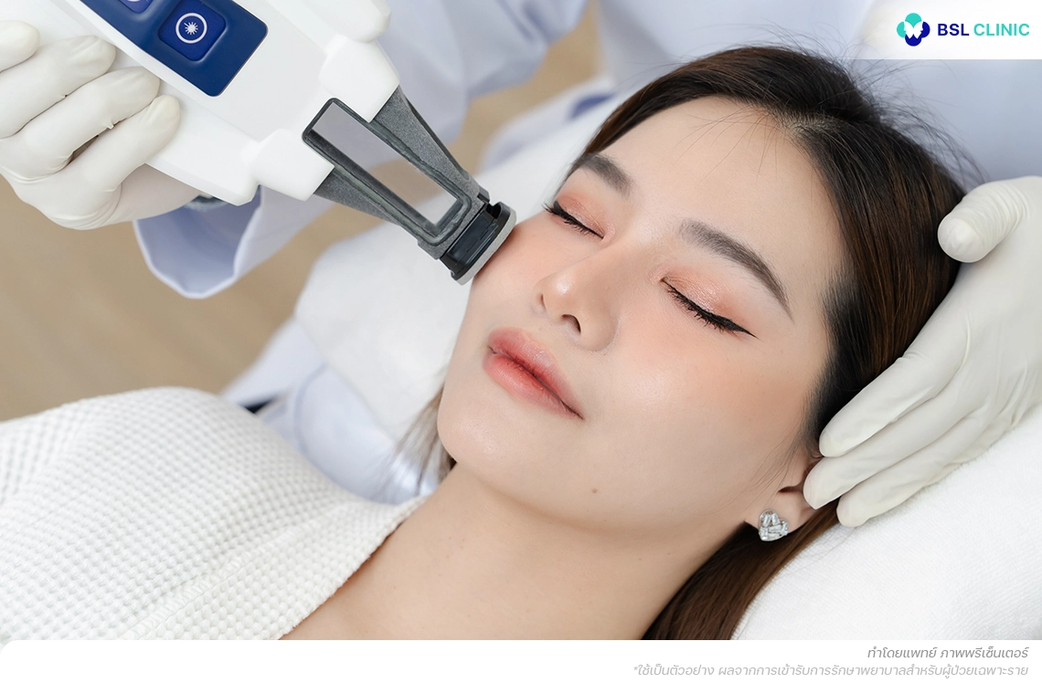Accure Laser เลเซอร์ 1726 nm