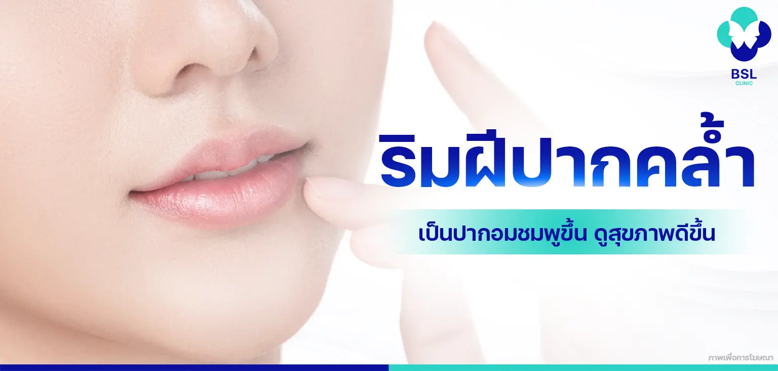 โปรแกรมเลเซอร์ริมฝีปากคล้ำ