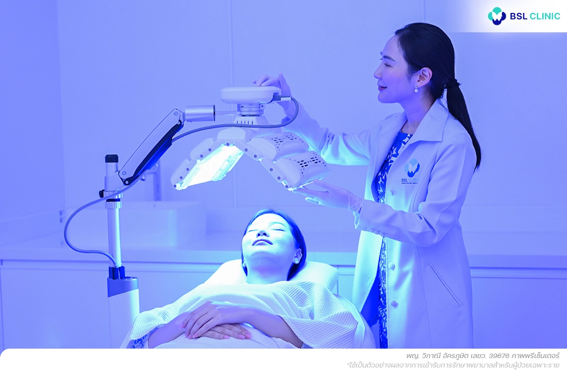 ฉายแสงลดเชื้อแบคทีเรีย-C-acnes ที่ทำให้เกิดสิวอักเสบ