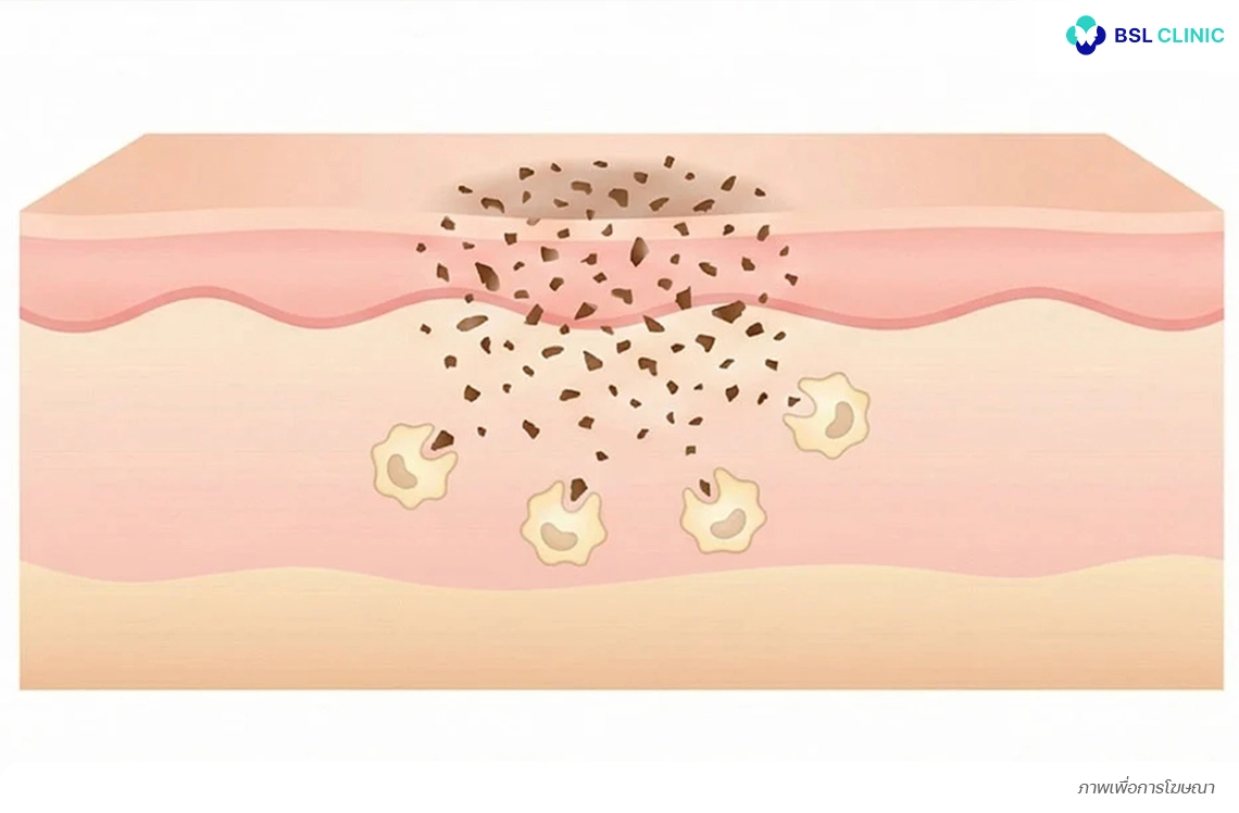 เม็ดสีแตกออกอย่างละเอียด