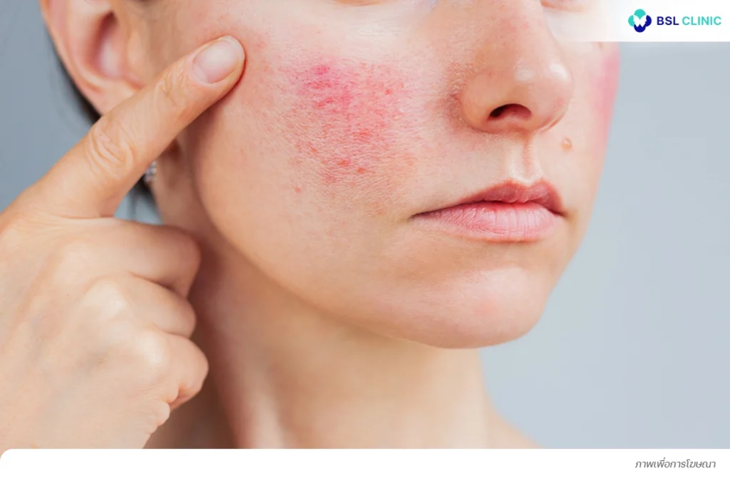 ผิวบอบบาง