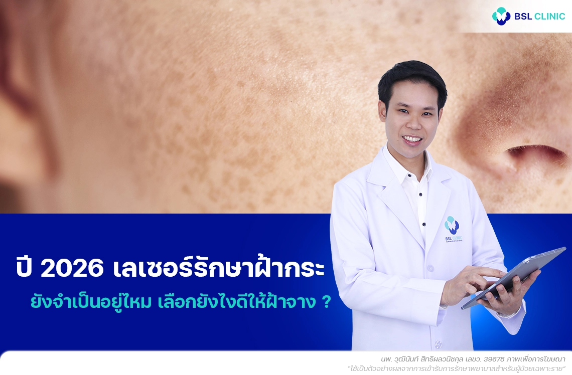 ปี 2026 เลเซอร์รักษาฝ้ากระ ยังจำเป็นอยู่ไหม เลือกยังไงดีให้ฝ้าจาง