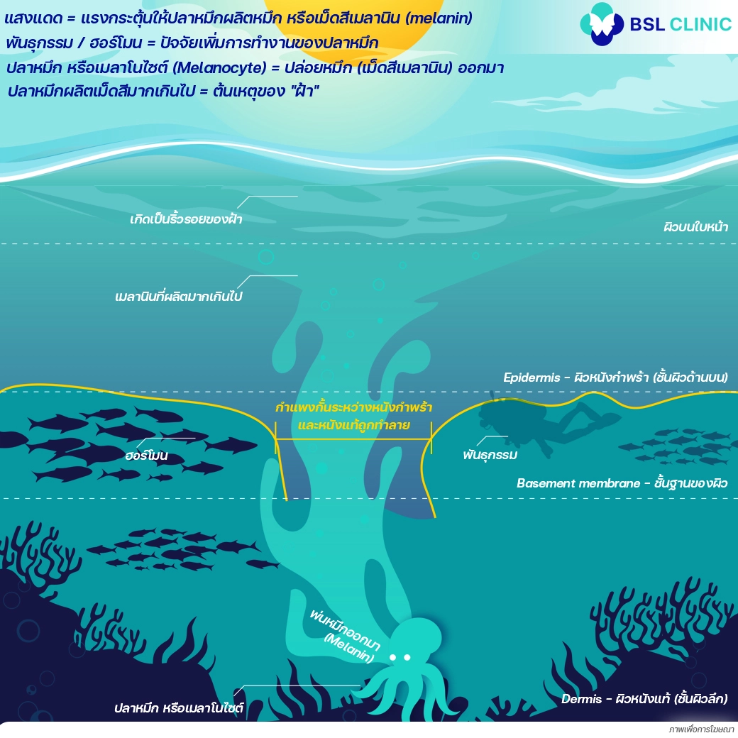 กลไกการเกิดฝ้า