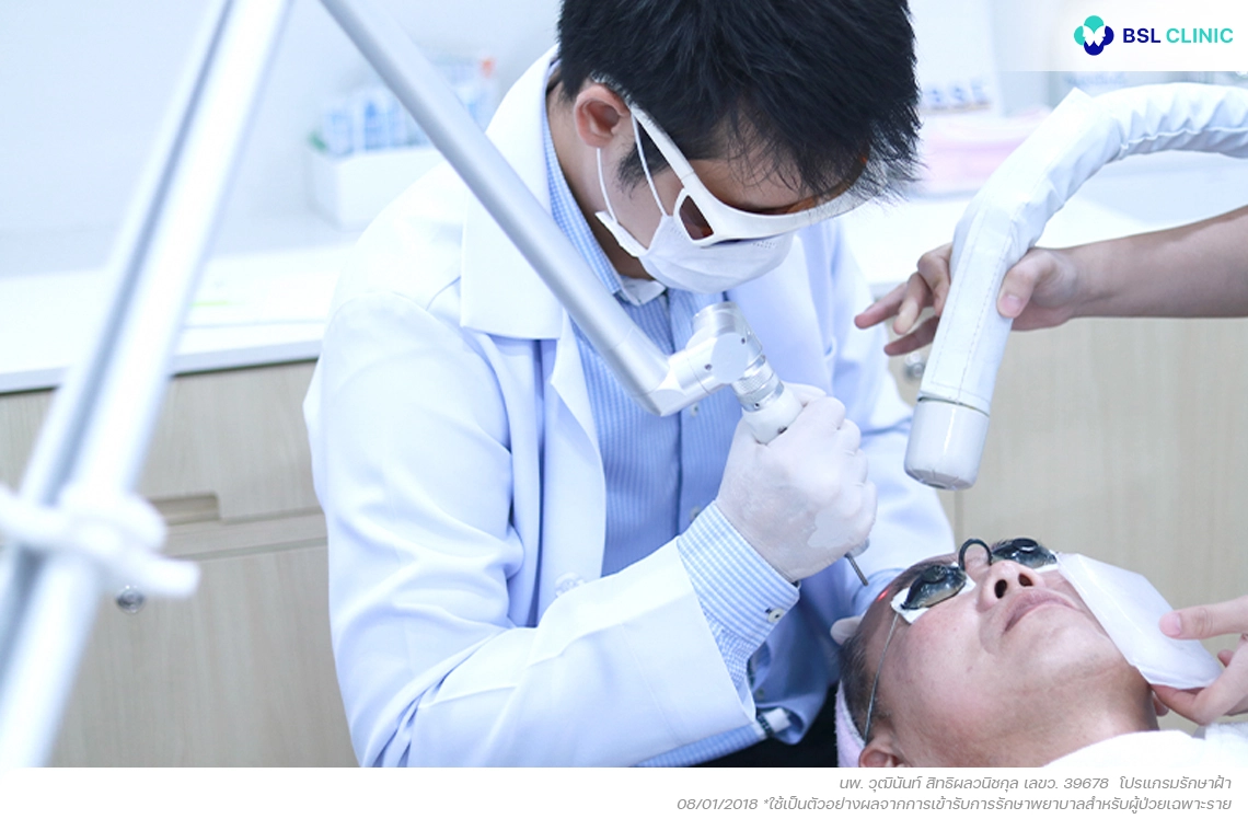 ลดเม็ดสีฝ้า