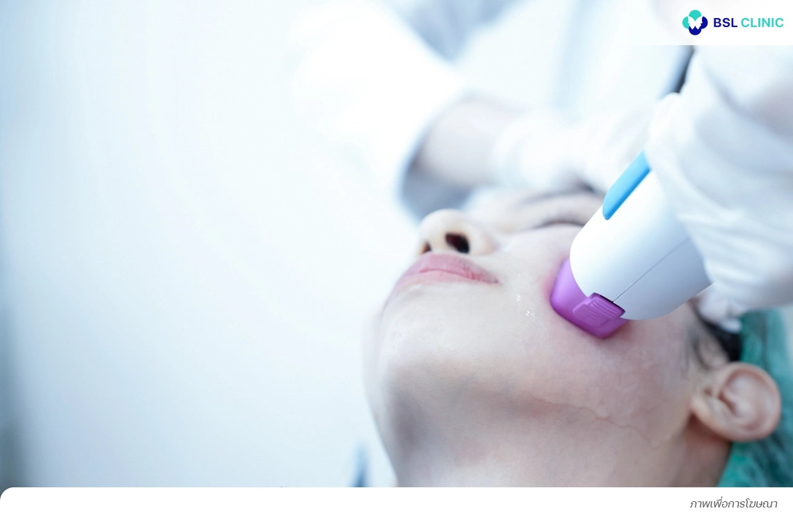 ใช้เลเซอร์ที่ไม่เหมาะกับประเภทของฝ้า