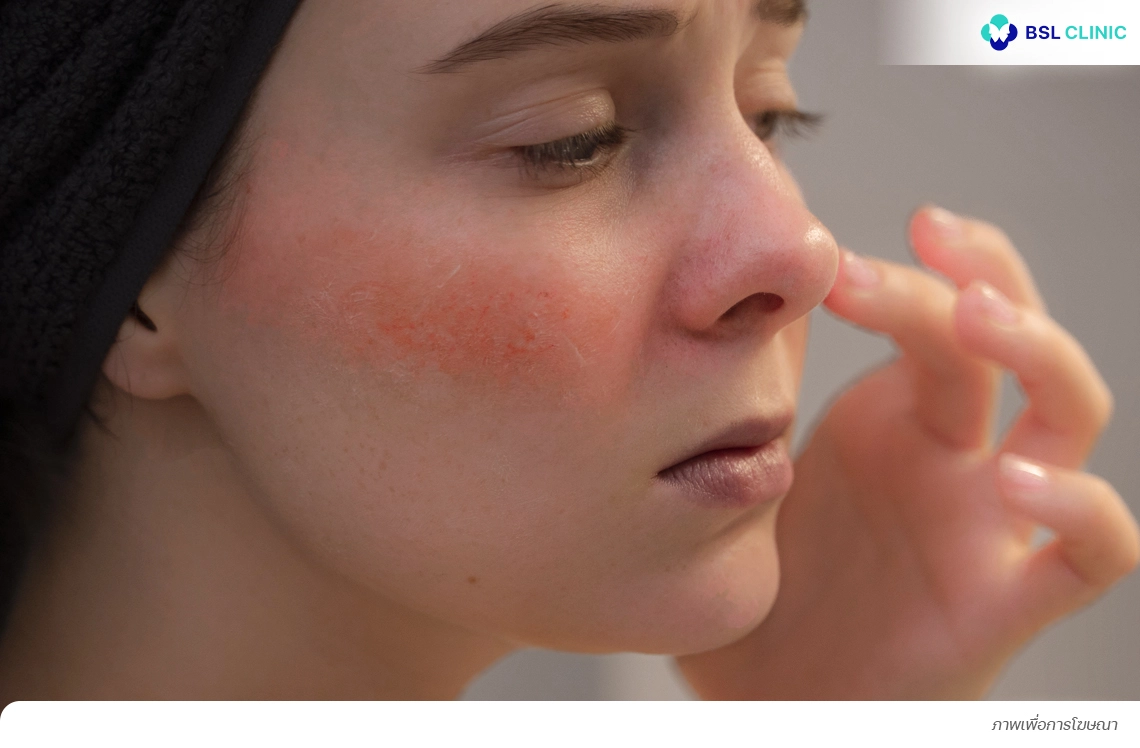 ผิวบาง ผิวแพ้ง่าย