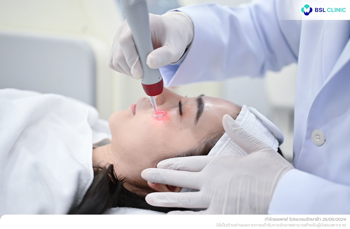 วิธีรักษาฝ้าและเทคโนโลยีเลเซอร์ที่ใช้อย่างแพร่หลาย