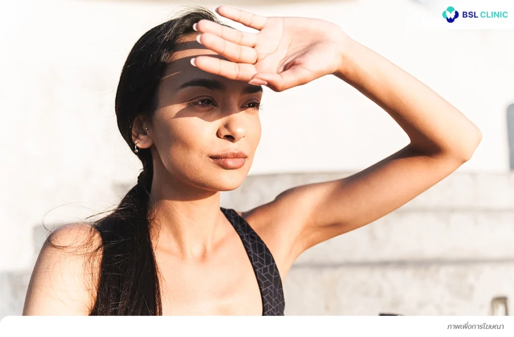 แสงแดด ปัจจัยกระตุ้นการเกิดฝ้าที่โหนกแก้ม