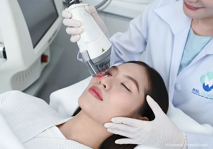 คุณหมอ-BSL-รักษาฝ้า-โดยคุณหมอ-fraxel-dual