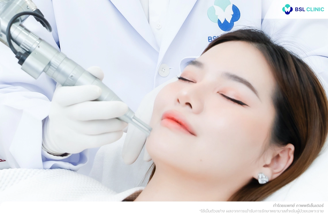 รักษาฝ้ากับแพทย์ที่มีความเข้าใจด้านเม็ดสีฝ้า